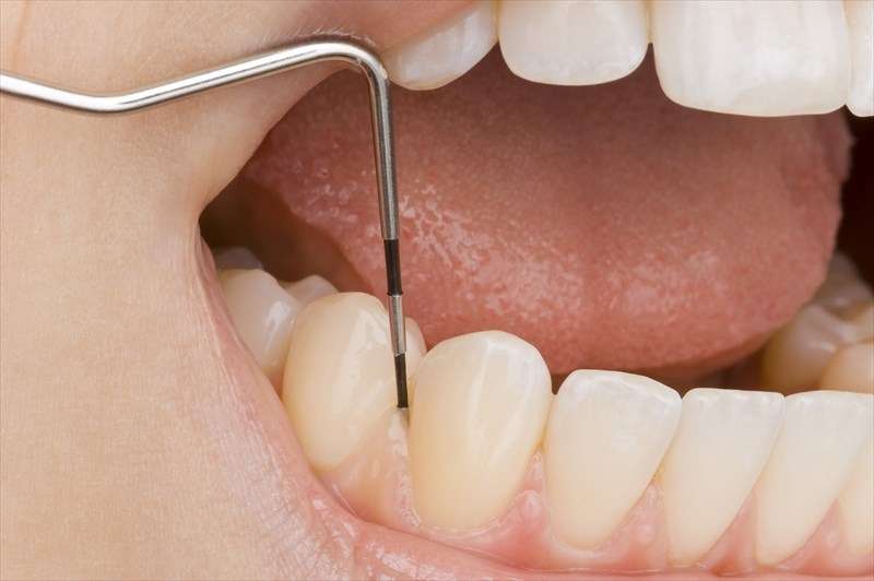 将来に歯を残す大人の矯正や競技力向上のための矯正も実施