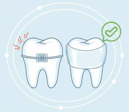 金属アレルギーが心配でインプラントを諦めていませんか？
