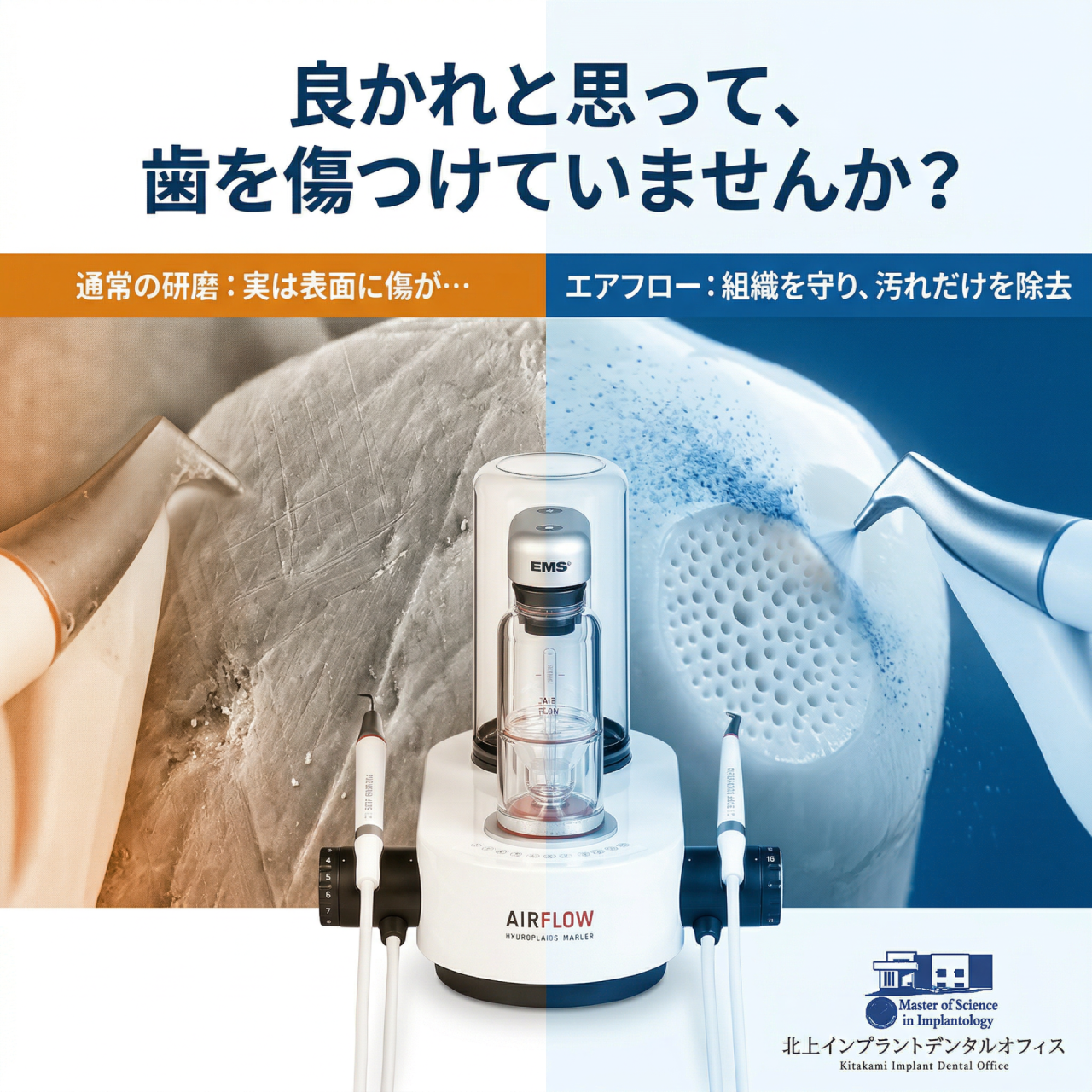 【ビジネスマンの新習慣】インプラントの資産価値を守る「エアーフロー」という賢い投資