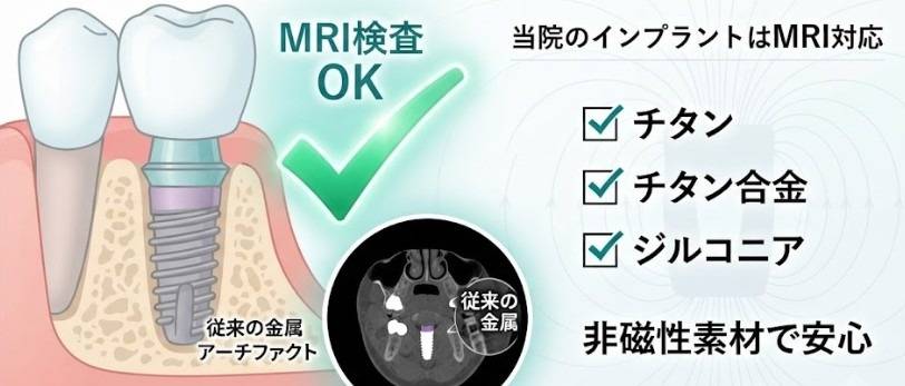 歯科インプラントとMRI検査について