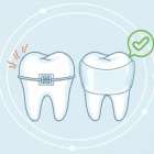 金属アレルギーが心配でインプラントを諦めていませんか？
